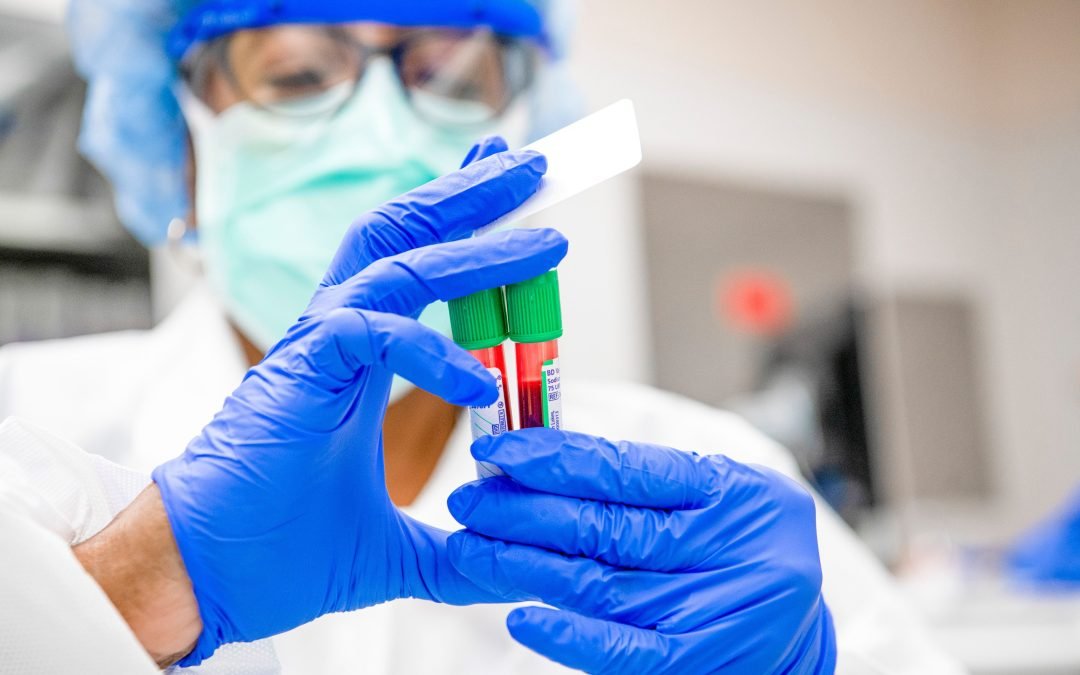 Novedosa terapia da resultados positivos en pacientes con anemia falciforme: Cleveland Clinic Children's